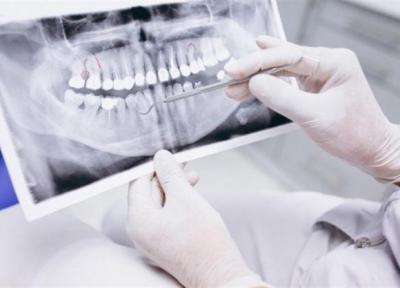 فراخوان شرکت در چالش نوآوری اصلاح سطح تجهیزات دندانپزشکی تیتانیومی و فولادی با پوشش DLC