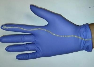 دستکش جراحی که از مرگ نوزادان جلوگیری می نماید